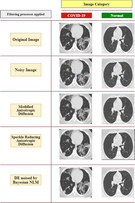 Category wise (COVID-19 and normal) images after different diffusion... | Download Scientific ...