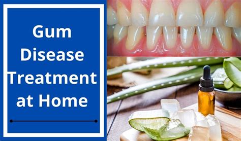 Gum Disease Treatment at Home