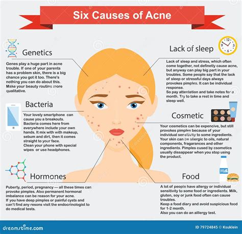 Causes of Acne. Skin Problems and Diseases Beauty Infographics Stock ...