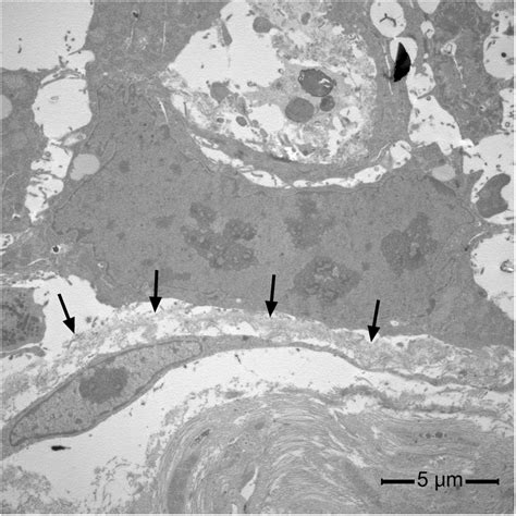 Transmission electron micrographs showing the absence of a basal lamina... | Download Scientific ...