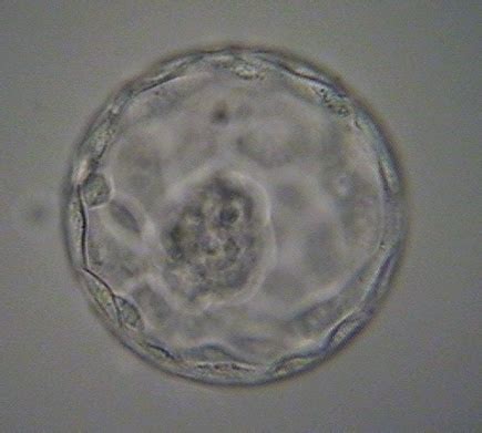 Blastocyst Culture | Fertility Solutions