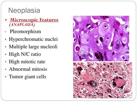 PPT - Neoplasia Introduction PowerPoint Presentation, free download - ID:1917544