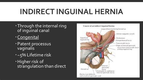 Hernia Mesh Types