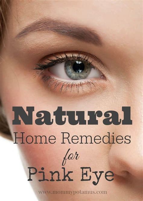 5 Natural Remedies For Pink Eye