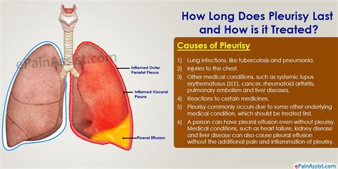 Pathophysiology Of Pleurisy