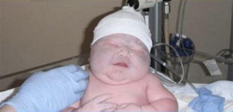 World Guinness Record In Boston World’s Biggest Baby Girl Ever Born | News Today