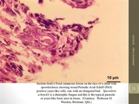 Dimorphic fungi