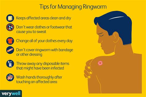 Ringworm Treatment: OTC, Prescription, and Natural Options