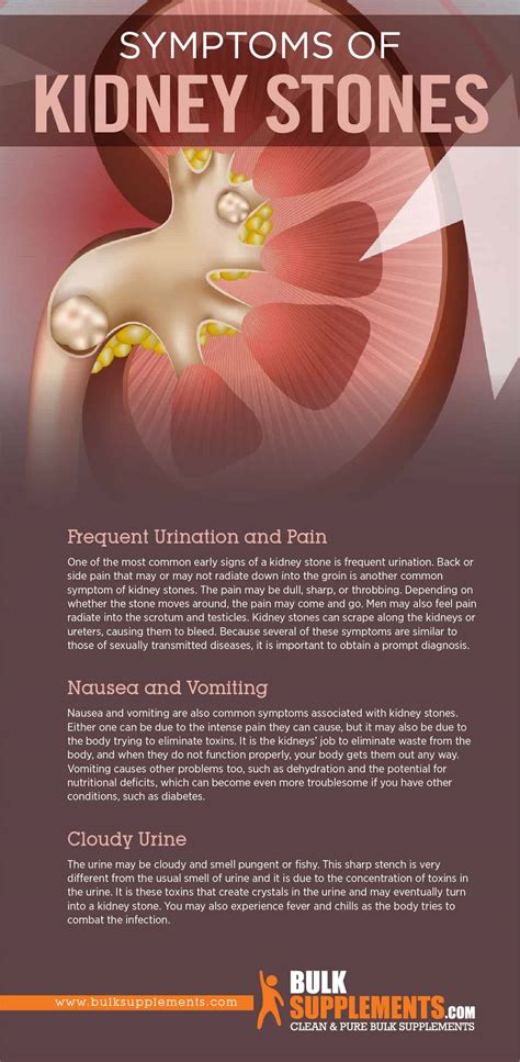 Kidney Stones: Symptoms, Causes & Treatment