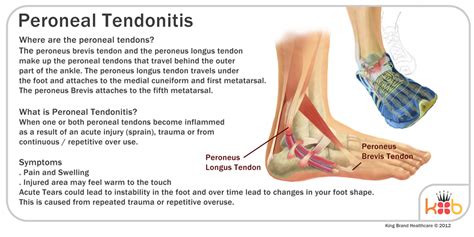 Peroneal Tendonitis Treatment