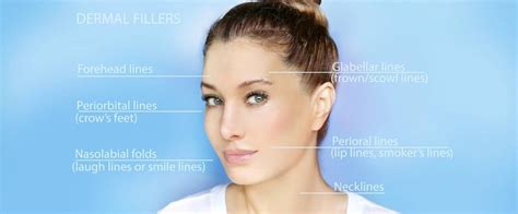 A Complete Guide to Filler Injections - Sullivan Dermatology