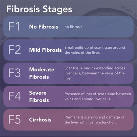 How does Fibroscan measure liver stiffness? - Dr Kaiser Raja