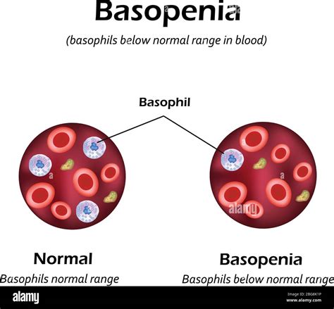 Basophils Blood Test