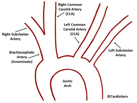 Carotid Artery Anatomy Cardioserv