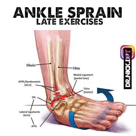 Dr. Nick Helton, DPT, OCS CSCS on Instagram: “[ LATE PHASE ANKLE SPRAIN ] --- Ankle sprains are ...