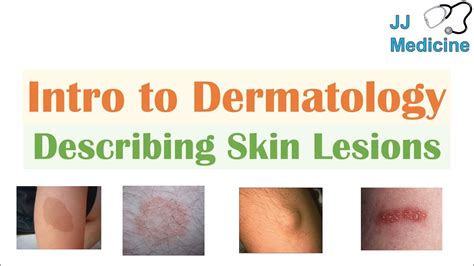 Primary Skin Lesions Chart