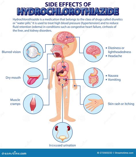 Human Anatomy Diagram Cartoon Style Of Hydrochlorothiazide Side Effects Vector Illustration ...