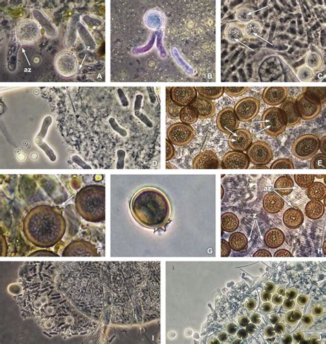 Formation of resting spores of Neozygites floridana in Tetranyhus... | Download Scientific Diagram