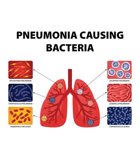 Pneumonia Symptoms Exposed: A dive into Diagnostic Insights