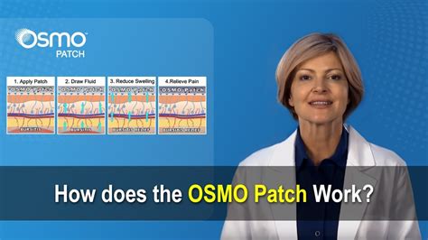 Download free Osmo Patch For Bursitis Reviews software - anibackuper