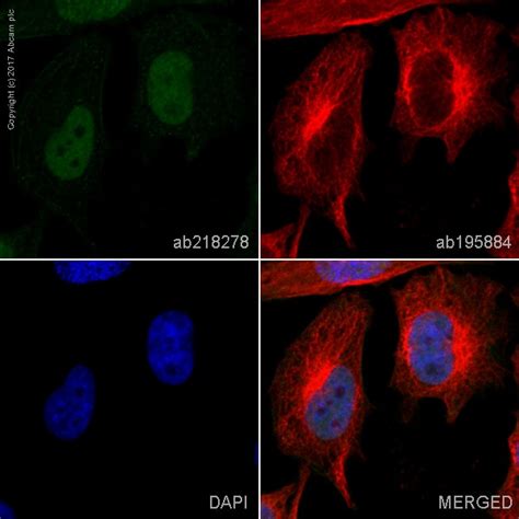 Alexa Fluor® 488 Anti-Timeless antibody [EPR5275] (ab218278) | Abcam