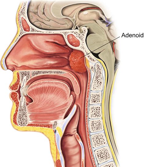 Location Of Adenoidsthe Structure Of The Nasopharynx