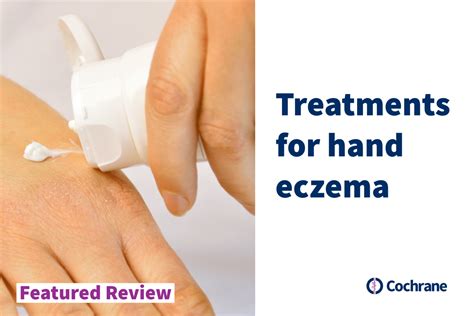 Featured Review: Treatments for hand eczema | Cochrane