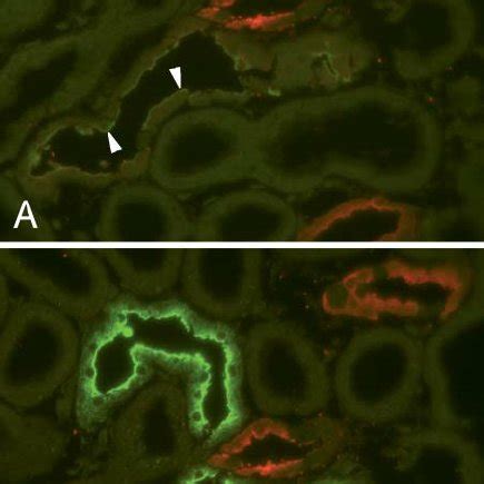 Fluorescence LM showing resistance of Alexa Fluor 488 immunoreactivity ...