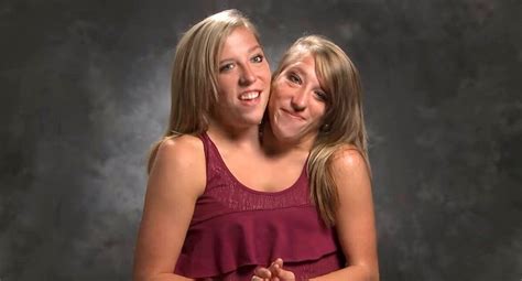 Conjoined Twins Abby and Brittany Hensel Now Work as Teachers