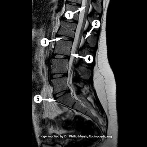 lunes cojo jazz mri spine anatomy Municipios Barcelona entregar