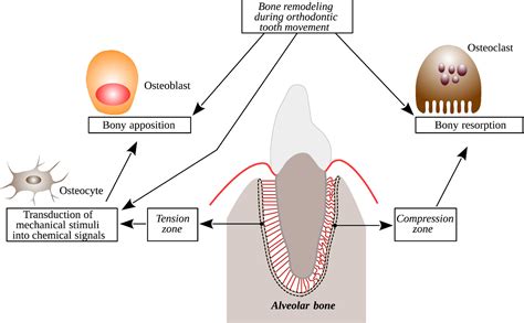 Bone remodeling during orthodontic tooth movement - Bone formation and ...