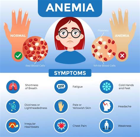 Consult for Anemia - My Nature Coach