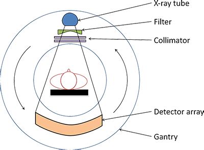 Beam Collimation Ct Scan - The Best Picture Of Beam