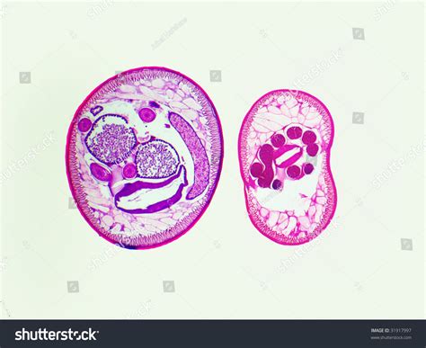 Ascaris Lumbricoides Male And Female Cross Section Images And Photos | The Best Porn Website