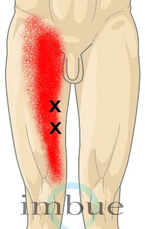 Thigh Pain: Where is it Coming From & What to Do? - Dr. Peter Borten, LAc, DAOM