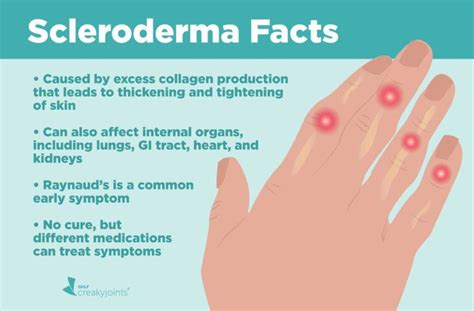 Scleroderma Facts Scleroderma Symptoms, Autoimmune Disease Symptoms, Autoimmune Disorder, Crest ...