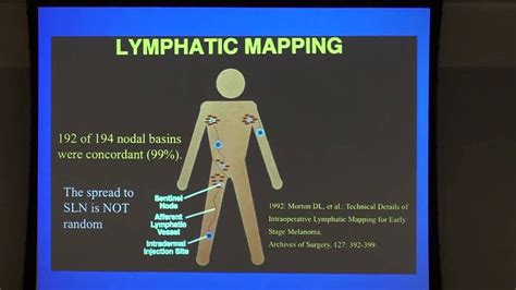 Melanoma Lymph Node Surgery