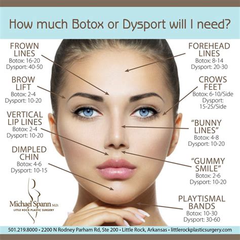 botox dysport near me - Edie Quinlan