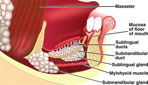 Excision of Sublingual Gland | Pocket Dentistry