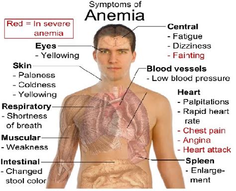 anemia symptoms | chemical elements