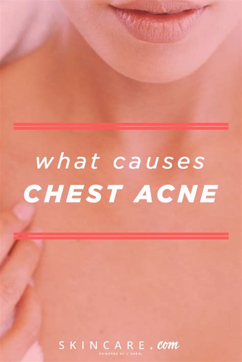 7 Common Causes of Chest Acne and How to Treat It | Skincare.com by L'Oréal | Chest acne, Body ...