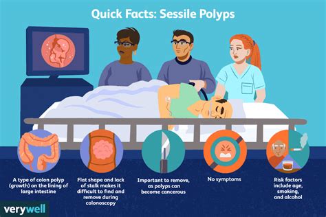 Sessile Polyp: Symptoms, Causes, Diagnosis, and Treatment