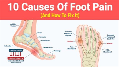 10 Causes Of Foot Pain (And How To Fix It)