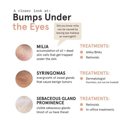 Treatment, Skin Cells, Bumps Under Eyes, Undereye, Did You Know, Eye Makeup, Skin Care ...