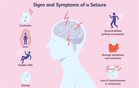 Epilepsy: Treatment, Symptoms and Causes