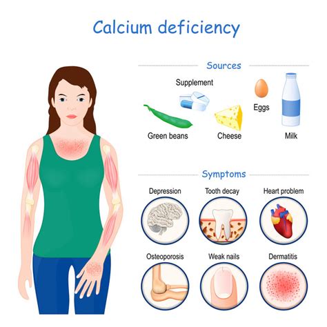 The Benefits of Using Calcium Supplements Daily