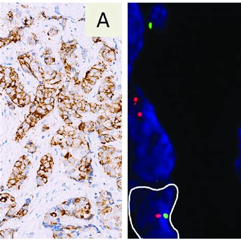 Multiplex immunohistochemical analysis for simultaneous detection of... | Download Scientific ...