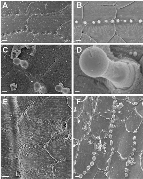 Fungi growing between cuticular microscutes of millipedes of the family... | Download Scientific ...