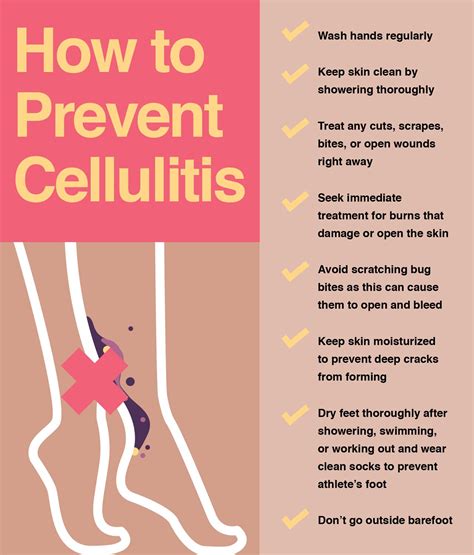 Cellulitis Treatment