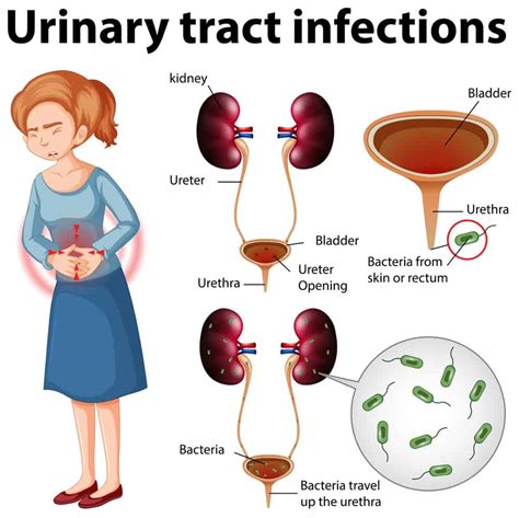 Urinary Tract Infection (UTI) – Symptoms, Diagnosis, and Treatment – Costamedic